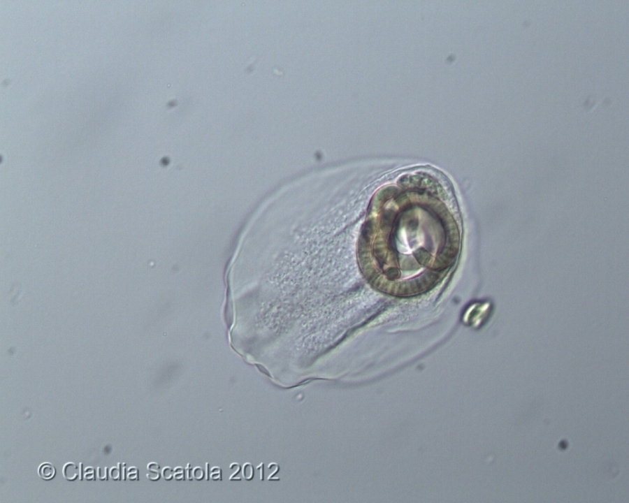 Ameba e cianobatteri